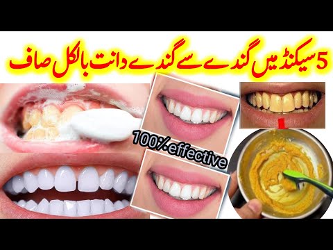 Teeth whitening At Home| Dant Saf krny ka tarika
