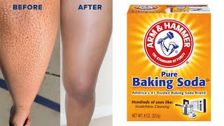 how to get rid of strawberry legs in 7days!!