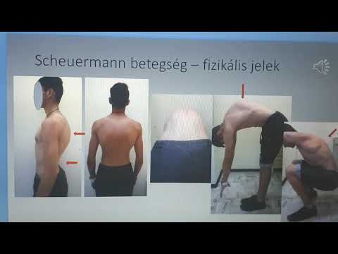 csípőtörés konzervatív kezelés ha a térdízület fáj hogyan kell kezelni