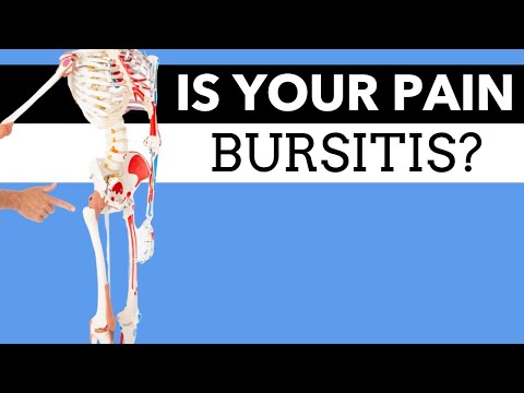 What Is Causing Your Hip Pain? Bursitis? How to Tell.