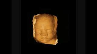 3D Ultrasound Cine Clip Fetal Face
