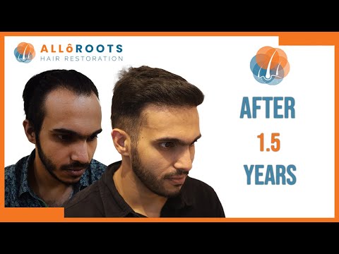 Patient testimonial