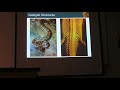 VestigialStructuresWhalesMVI 7968