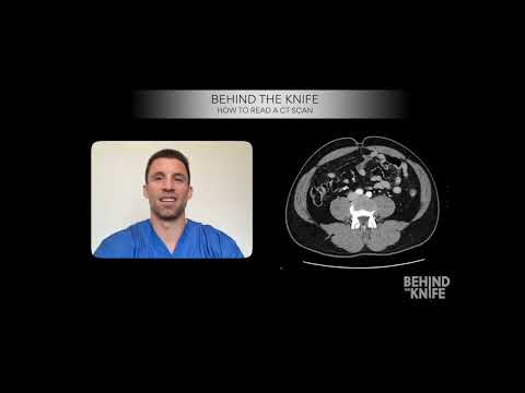 Behind the Knife - How to Read a CT Scan