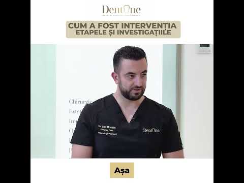 Fast & Fixed: Dinți Noi, Rapid și Fără Durere!