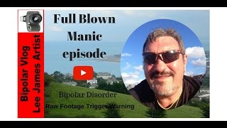 Bipolar Disorder Full Blown Manic Episode