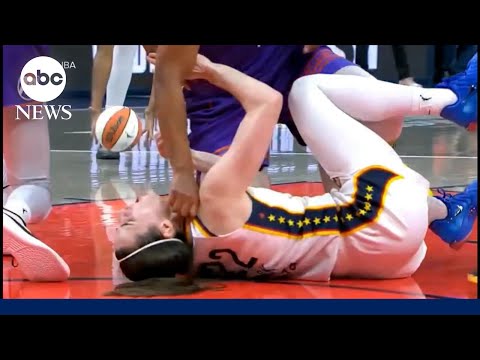 Growing outrage over hard foul against Caitlin Clark