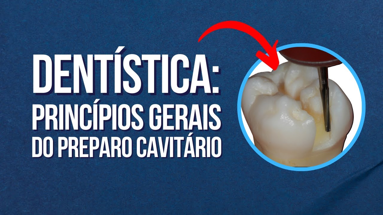 Princípios gerais do preparo cavitário