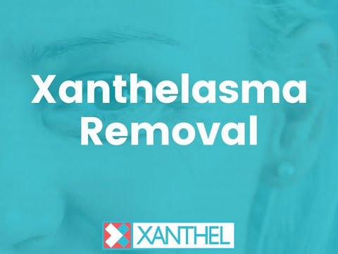 Xanthelasma Removal