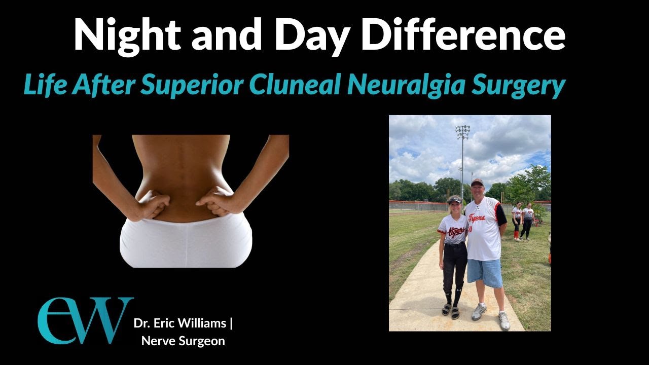 Night and Day Difference: Life After Superior Cluneal Neuralgia Surgery