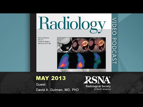 Multi-institutional Study of the TCGA Glioblastoma Data Set (May 2013 Radiology Podcast)