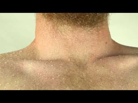 download lagu mp3 mp4 Limax Berlin, download lagu Limax Berlin gratis, unduh video klip Limax Berlin