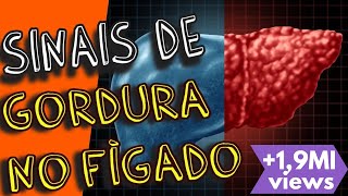 Sintomas de Gordura no Fígado ou Esteatose Hepática (fígado gorduroso)