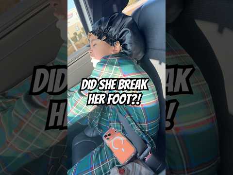 How did her foot even get like that #shorts #scarlett #viral