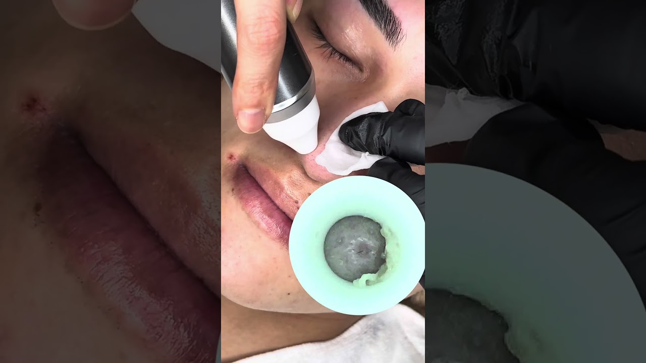 #asmr #Bubble毛穴洗浄#毛穴洗浄#角栓 #メンズ専門