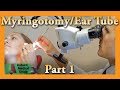 Myringotomy & Ear Tube Part 1 Feat. Dr. Tim Fife : Myringotomy | Auburn Medical Group