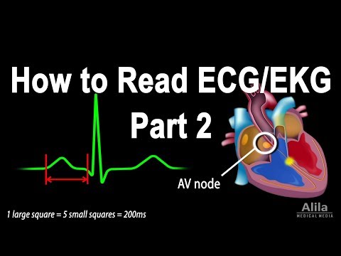 How to Read ECG/EKG, Part 2, Animation