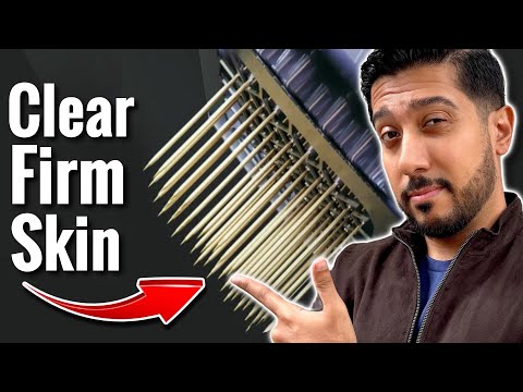 Morpheus 8 to Tighten Skin | Watch BEFORE Doing Morpheus 8