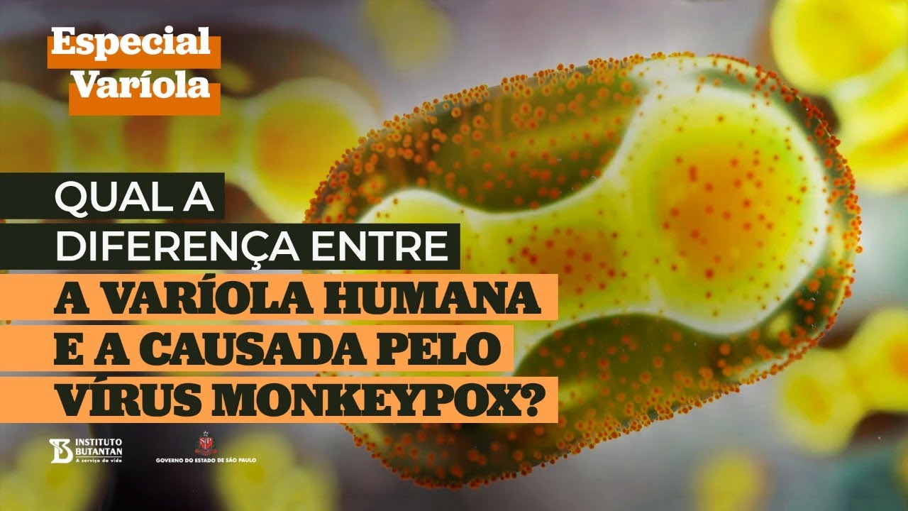 Especial Varíola - Qual a diferença entre a varíola humana e a causada pelo vírus Monkeypox?