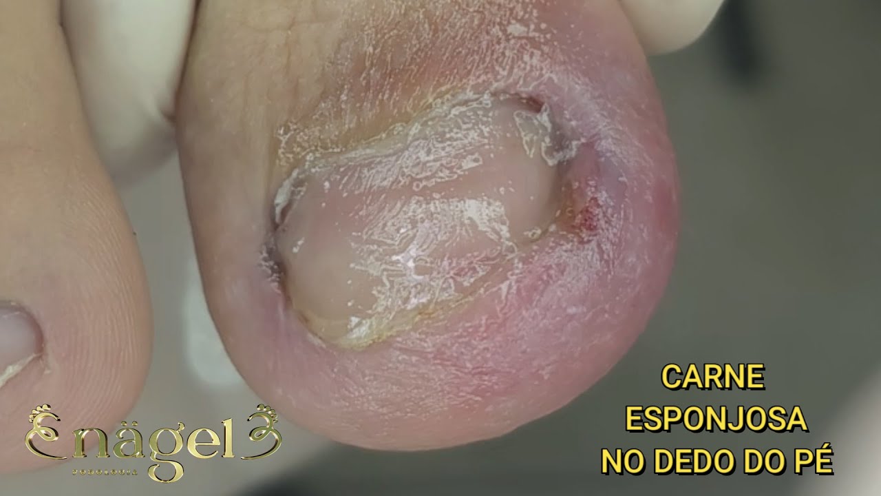 😨 COMO RESOLVER ISSO DE UMA VEZ POR TODAS! #satisfying #nails