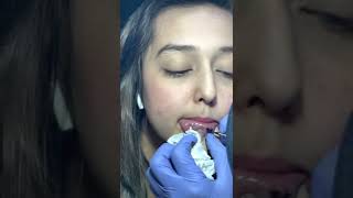 Download lagu Bule Cantik Yang Jago Bahasa Sunda - TATO BIBIR mp3 Download lagu Bule Cantik Yang Jago Bahasa Sunda - TATO BIBIR mp3