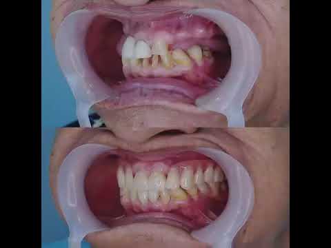 video wPsekO6v8LI