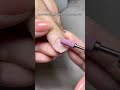 Tackle Thick Enhancements With Ease