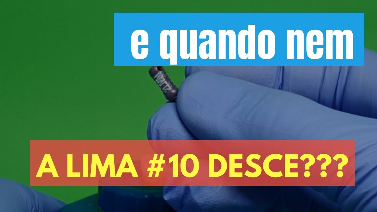 E NAQUELE CANAL ATRÉSICO QUE NEM A LIMA #10 DESCE? - QUICK TIP ENDOLOVERS