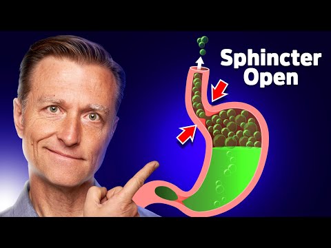 #1 Remedy for Heartburn / Acid Reflux / GERD without Medications