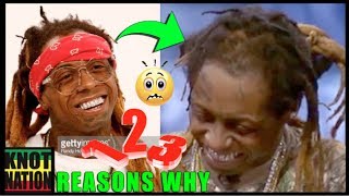 3 Reasons Why Lil Wayne has Bald Dreadlocks
