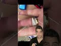 Ring Removal