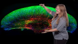 Julie Theriot (Stanford, HHMI) 2: Mechanics and Dynamics of Rapid Cell Motility