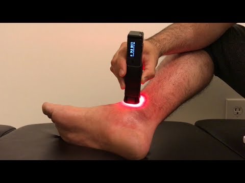 download lagu mp3 mp4 Witch Hazel For Spider Bites, download lagu Witch Hazel For Spider Bites gratis, unduh video klip Witch Hazel For Spider Bites