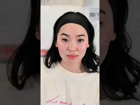 BB laser and Rejuran healer for skin rejuvenation. #skincare #rejuran #glowup