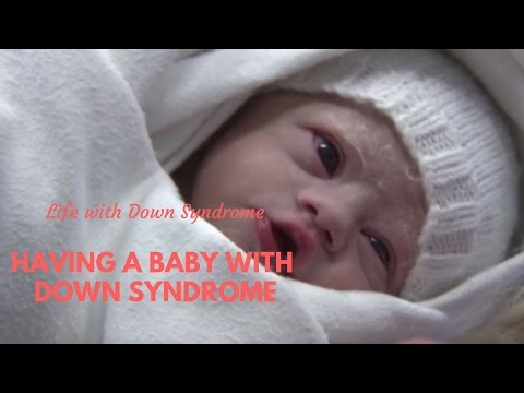 Watch video Having a Baby with Down Syndrome