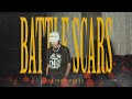 Battle Scars - Clinxy (Official MV)