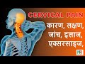 Cervical Pain सर्वाइकल पेन के क्या कारण है 5 Exercise 
