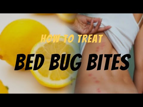 YouTube video about: How to get rid of bed bug bites scars?