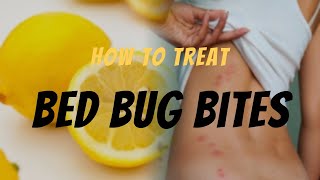 Bed Bug Bite Relief: Effective Ways to Treat Bed Bug Bites - Remedies & Tips