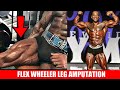 Flex Wheeler Had Emergency Leg Amputation