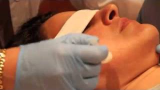 The mybody Probiotic Peel