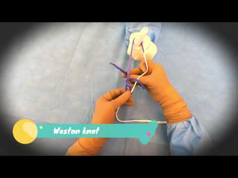 Laparoscopic Weston Knot