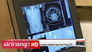 Korean researchers develop way to reduce radiation dose from X-rays, CTs