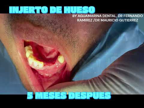 Mauricio Orlando Gutierrez Toro-59