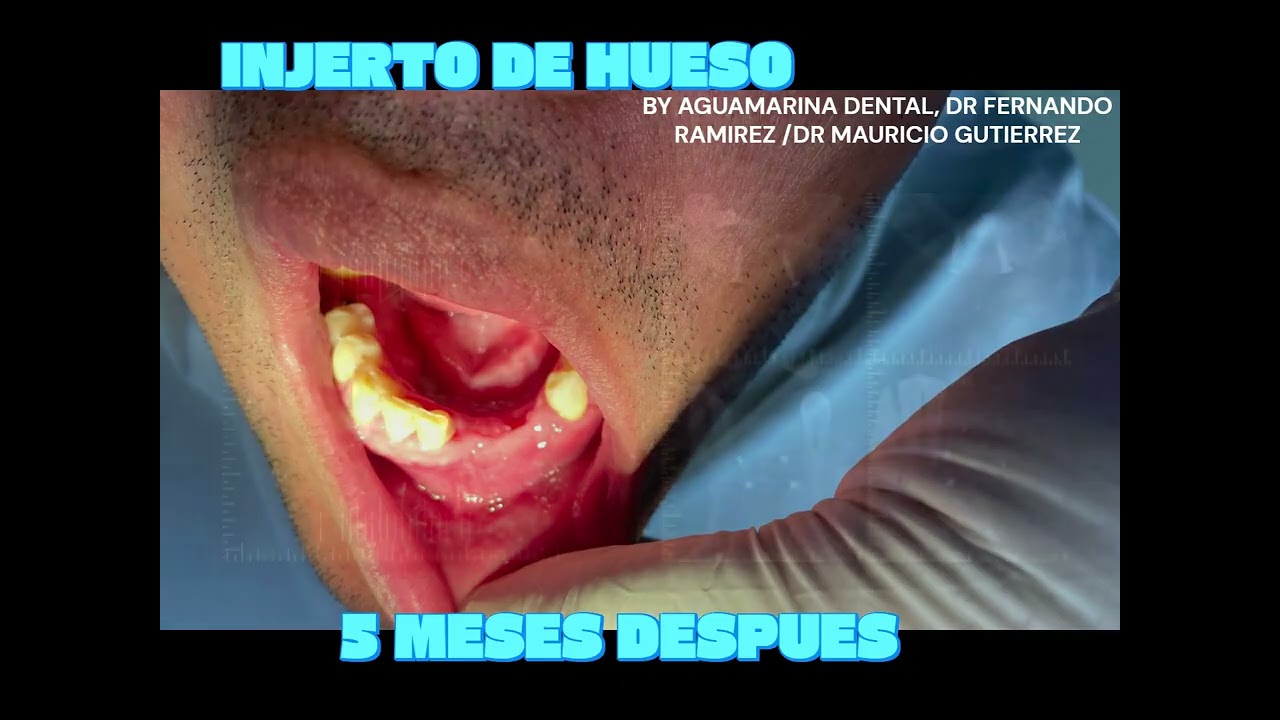 Mauricio Orlando Gutierrez Toro-59