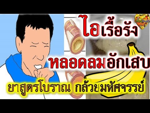 ค้อนประหลาดใจพรูโลหะ วิธีการที่ดีที่สุดเพื่อเพิ่มบ้านสมาชิก