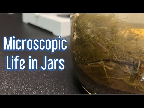 Pond Life Under the Microscope Is INSANE!