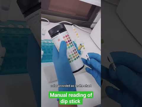 How to read urine dip stick #laboratory #urinalysis #dipstick