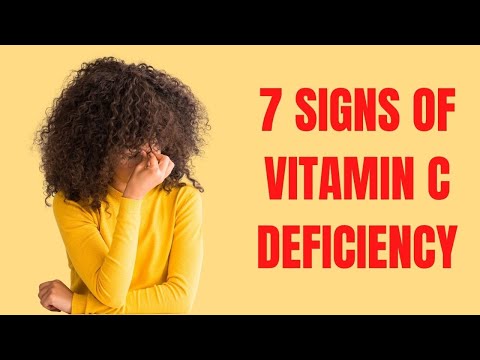 7 Signs of Vitamin C Deficiency You Should Know | Healthy Living Tips