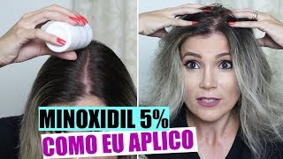 COMO APLICAR MINOXIDIL - NÃO RESSECA O CABELO